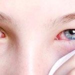 Виды болезней глаз, их симптомы и лечение
